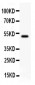 Anti-Gamma Catenin Picoband Antibody